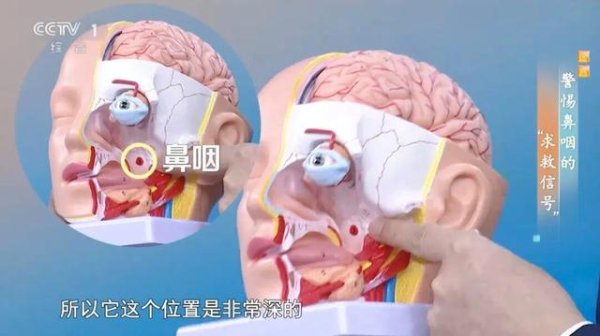 kaiyun官方网站不外这种流鼻血与抠鼻子形成的流鼻血不相通-开云·Kaiyun(中国)官方网站-科技股份有限公司